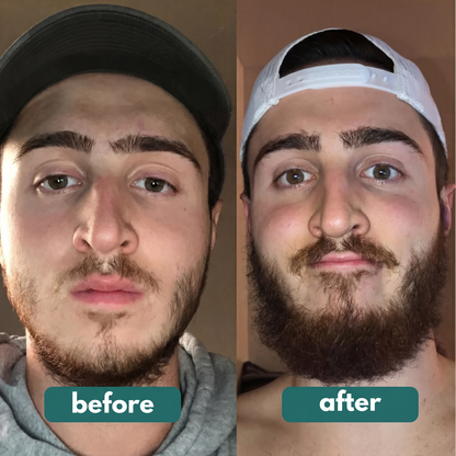 Follixir – Beard Growth Serum