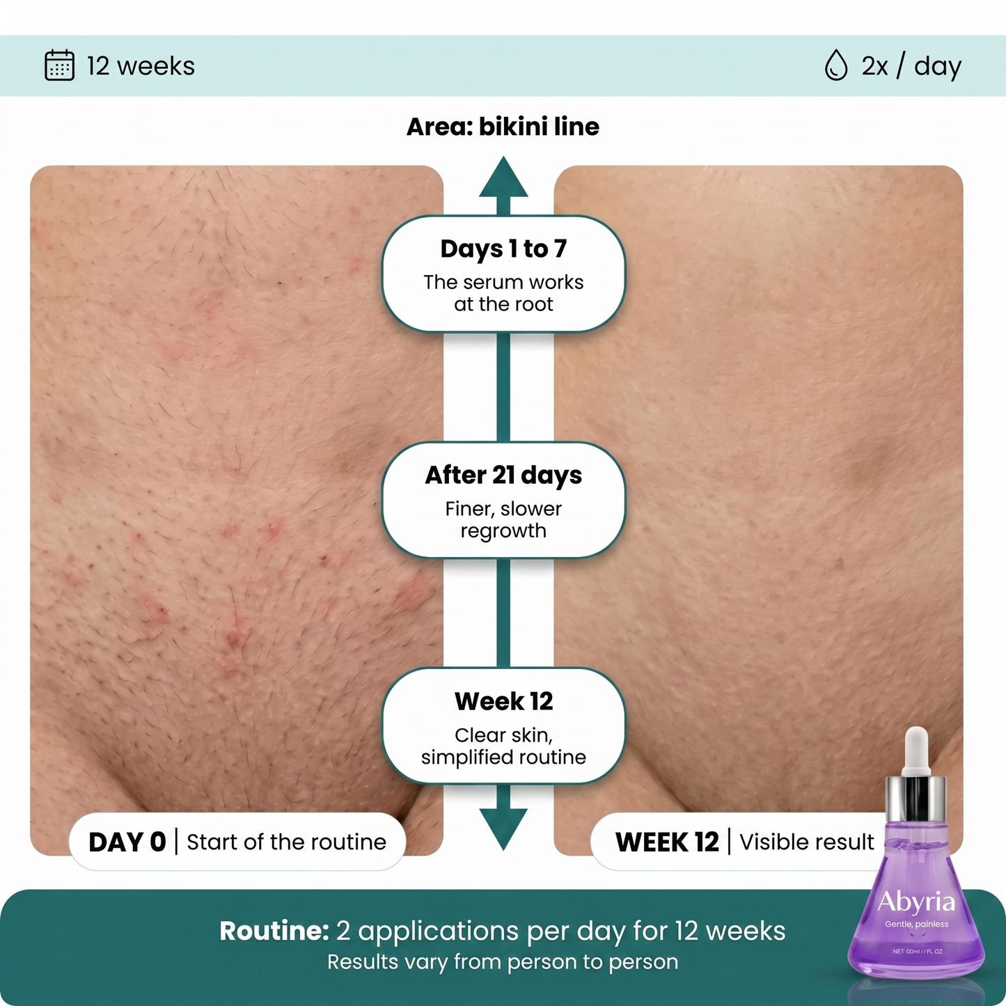 Abyria - Hair Growth Inhibitor Serum