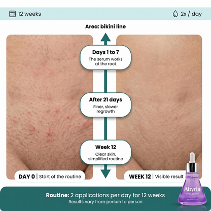 Abyria - Hair Growth Inhibitor Serum